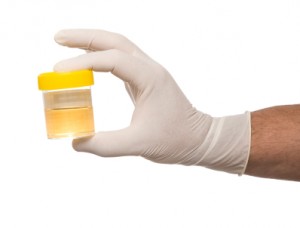 Drug testing methods